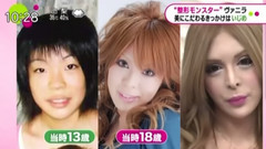 日本整容魔女,理想是法國人偶